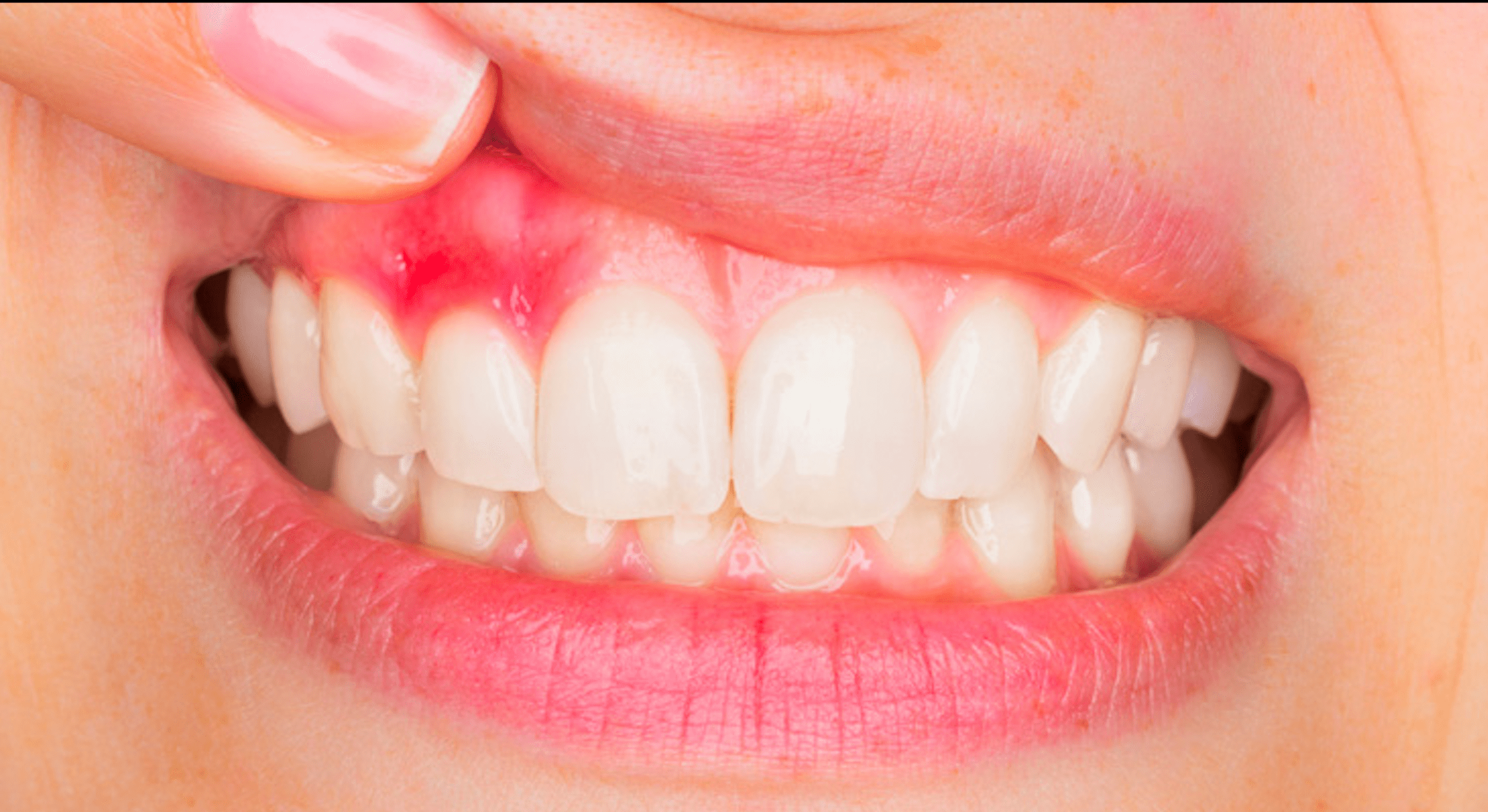 CES de parodontologie (en pause)