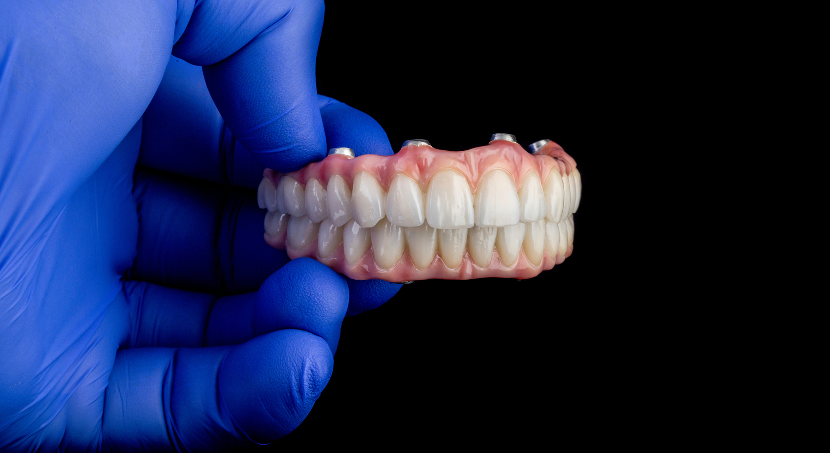 DU de réhabilitation orale mention prothèse